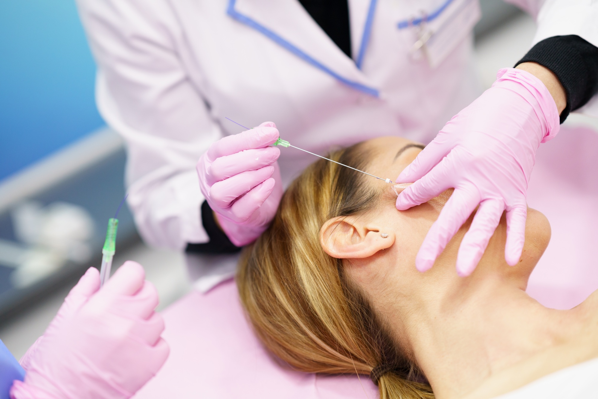 Doctor injecting PDO suture treatment threads into the face of a woman